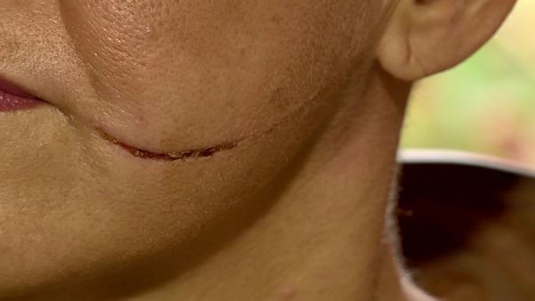 Mulher teve o rosto cortado com uma faca em Colatina 