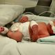 O pequeno João Guilherme nasceu de 7 meses e precisou da ajuda de aparelhos para respirar