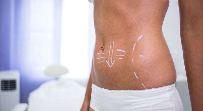 Aparelho de última geração destrói as células de gordura de forma segura. Ele promete resultados rápidos e dá para ser feito mesmo durante o verão