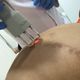 Imagem - Andressa Urach remove cicatriz no bumbum deixada por hidrogel