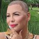 Imagem - Luisa Marilac fica careca para fazer transplante capilar: "Sonho"