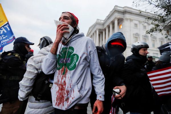Um apoiador ferido do presidente dos EUA Donald Trump reage durante um protesto contra a certificação dos resultados das eleições presidenciais dos EUA de 2020 pelo Congresso dos EUA, fora do Capitólio dos EUA em Washington, EUA, 6 de janeiro de 2021