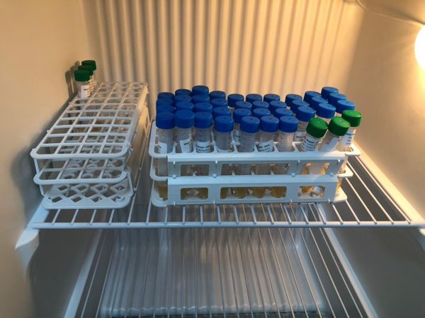 53 kits de testes para a Covid-19 foram perdidos