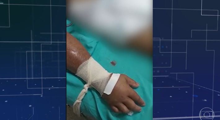 A Defensoria Pública abriu procedimentos sobre a denúncia, veiculada pelo Jornal Nacional, da Rede Globo, de que pacientes em Parintins estariam sendo amarrados para intubação