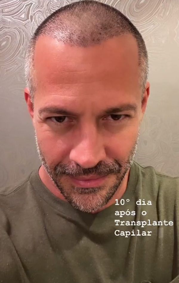 Malvino Salvador