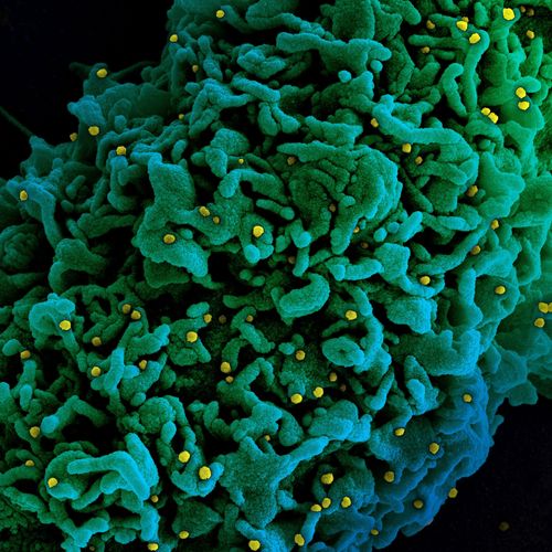 Um estudo da Fiocruz mostra que uma primeira exposição à Covid-19 em casos brandos ou assintomáticos pode não produzir resposta imunológica e que a pessoa pode se reinfectar