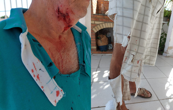 Idoso de 72 anos é atacado por dois cachorros em Linhares