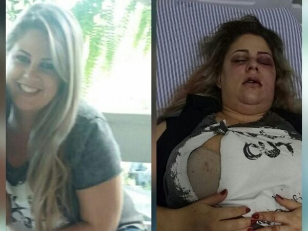 Mônica Peccini Mardegan, de 37 anos, após ser vítima das agresssões