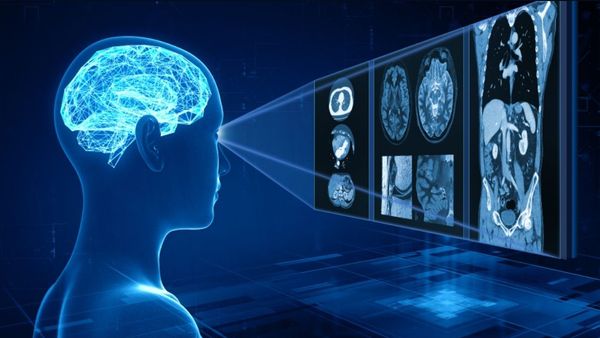 Para o médico radiologista Eduardo Pacheco, a inteligência artificial é o futuro da Medicina.