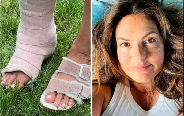 Mariska Hargitay compartilhou uma foto do tornozelo quebrado