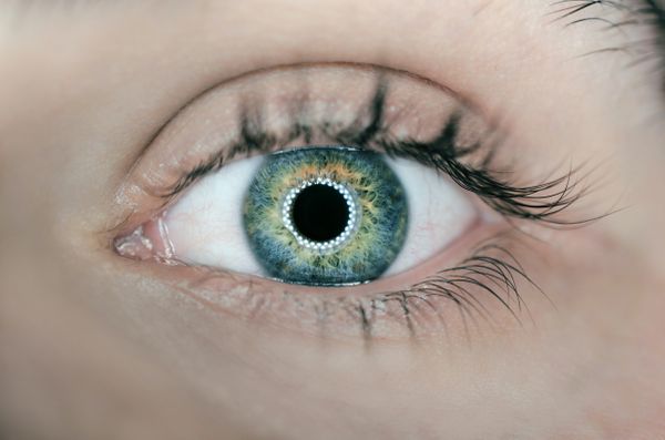 Segundo o médico Evandro Duccini, o câncer ocular ou de olho é uma neoplasia maligna que afeta alguma das estruturas do globo ocular. 