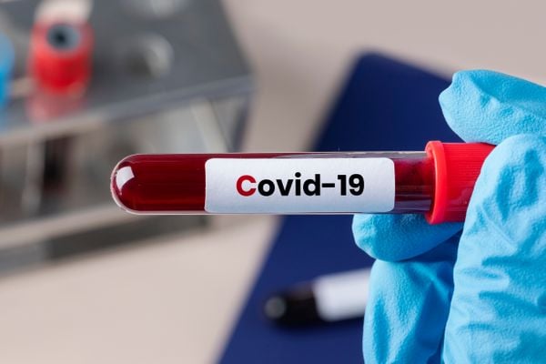 Sobreviventes da Covid têm enchido os consultórios médicos com sintomas variados
