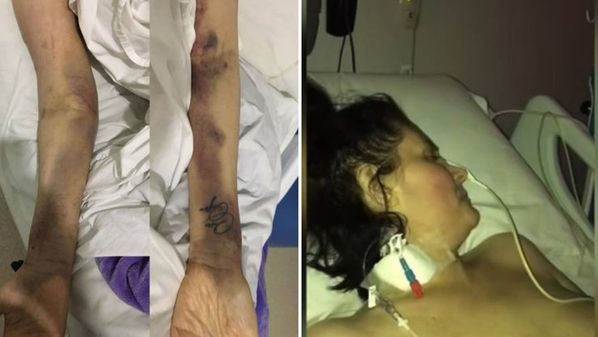 "Batalha extenuante", escreveu Malga di Paula, que já se recupera em casa