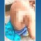 Imagem - Homem joga álcool e ateia fogo no corpo de morador de rua em Colatina