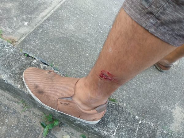 Motociclista é atingido por cavalo em Vila Velha por Divulgação | Redes sociais