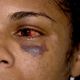 Imagem - Mulher passa 5 dias internada após agressão do companheiro em Colatina