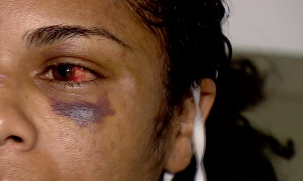 Mulher foi agredida a pauladas pelo ex-companheiro em Colatina