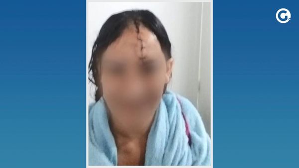 Manicure leva golpes de facão durante briga por ciúmes na Serra