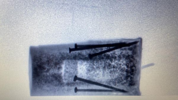 Imagem captada pelo raio-x do Esquadrão Antibombas