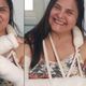 Atriz Elizangela usou o Instagram para comunicar que fraturou os dois antebraços após uma queda em casa