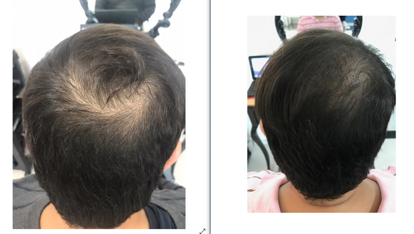 A Royal Drop tem uma linha 100% natural, com ativos nanotecnológicos, o que a torna sem contraindicações, com segurança dermatológica adequada. por Royal Drop/Divulgação