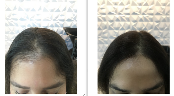 Os produtos são indicados para tratar diversos tipos de alopecia. por Royal Drop/Divulgação