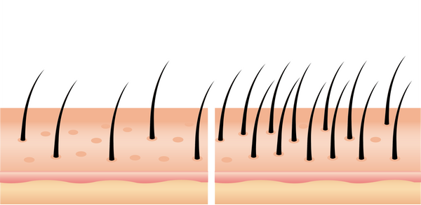 Antes e depois do uso de produto para queda de cabelo