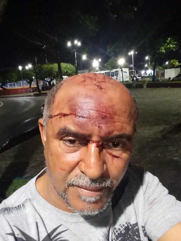 Wilson afirmou que foi agredido com socos na cabeça pelo filho antes do crime
