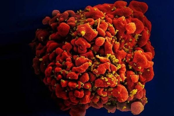 Glóbulo branco infectado com o HIV