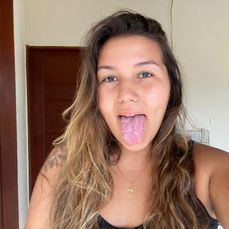 Moradora de Ibiraçu, a jovem, que trabalha como lavadora de carros, expôs na rede social a condição curiosa e pouco conhecida por muitos; veja o que diz a especialista e o que apontam os estudos