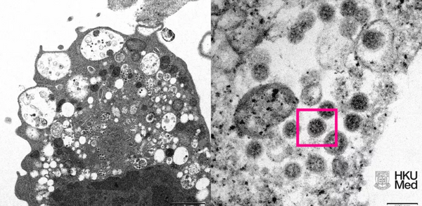 Imagem destaca variante ômicron do coronavírus feita com um microscópio