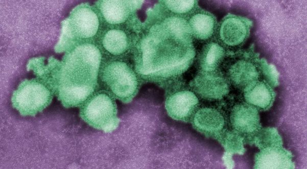 Influenza