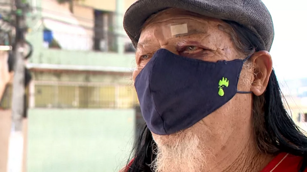 João Olavo da Silva, de 74 anos, deu entrevista a TV Gazeta após ser espancado em agosto.