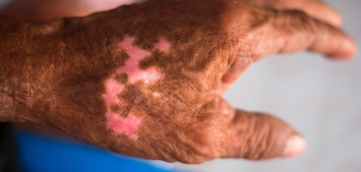 Especialista explica como combater o estigma e identificar sintomas