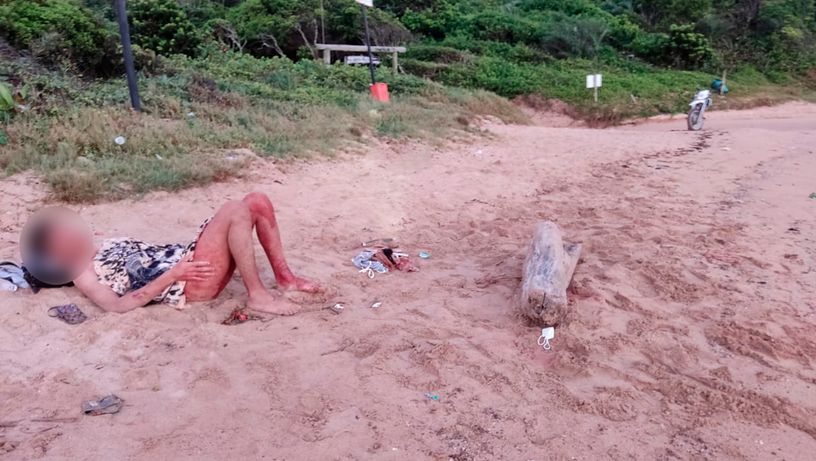 Rapaz encontrado com barriga aberta em praia de Guarapari