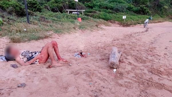 Rapaz encontrado com barriga aberta em praia de Guarapari