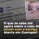 Imagem - Vídeo: o que se sabe sobre o caso do jovem que teve barriga aberta em Guarapari