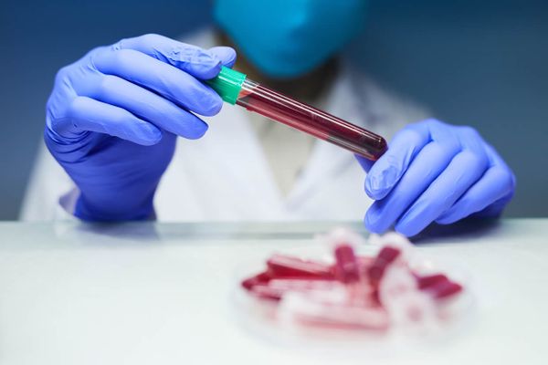 O segundo exame não detectou a presença de substâncias ilícitas no corpo do cliente do laboratório