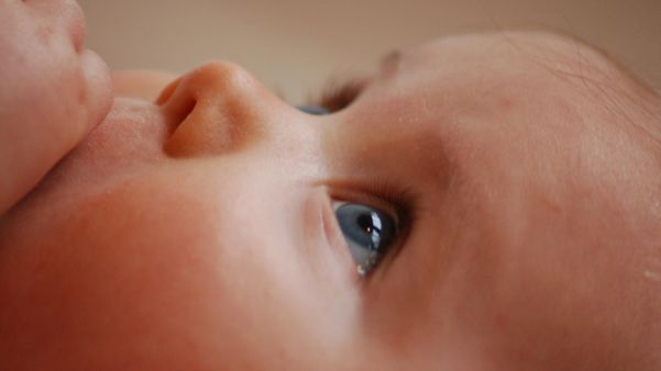 Bebê, olhos, retinolastoma