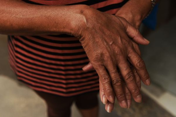 A idosa de 66 anos teve objetos pessoais levados pelo assaltante