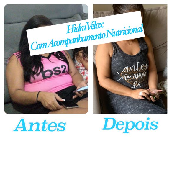 Com uma alimentação balanceada acompanhada por um profissional, os resultados de procedimentos estéticos serão mais satisfatórios.