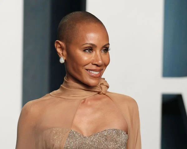 A atriz Jada Pinkett-Smith possui alopecia