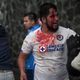 Imagem - Futebol mexicano tem nova briga sangrenta entre torcedores