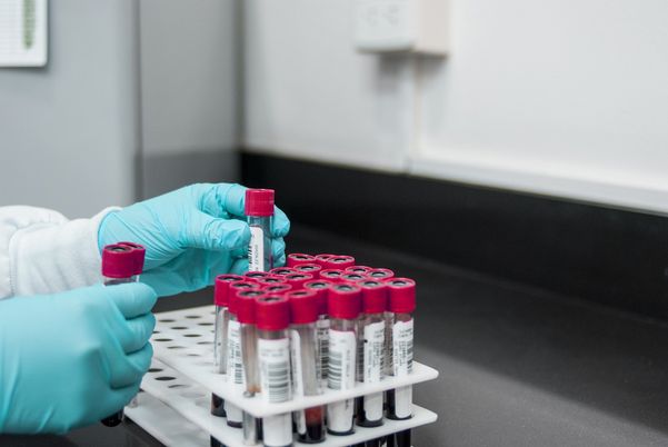 Amostras de sangue: OMS monitora casos de hepatite aguda de origem desconhecida em crianças da Europa