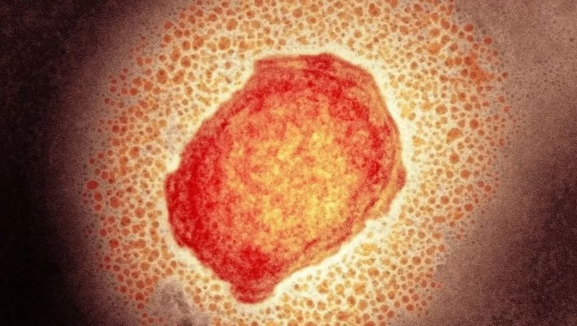 Partícula do vírus da varíola dos macacos; doença geralmente começa com sintomas semelhantes aos da gripe