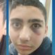 Imagem - Garoto autista é agredido com raquete por colega em escola no ES