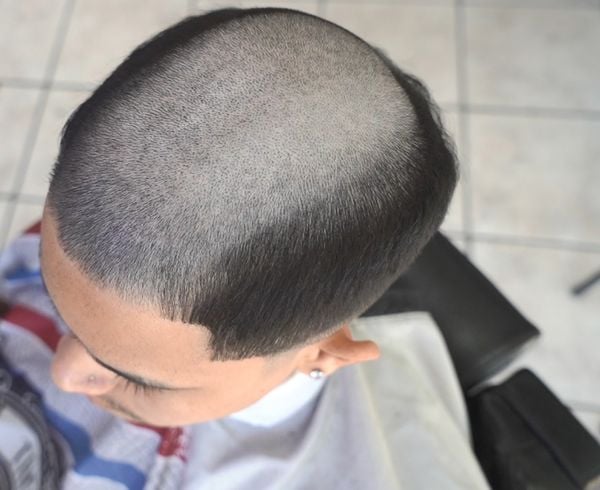 Calvície na moda! Corte de cabelo calvão de cria viraliza nas