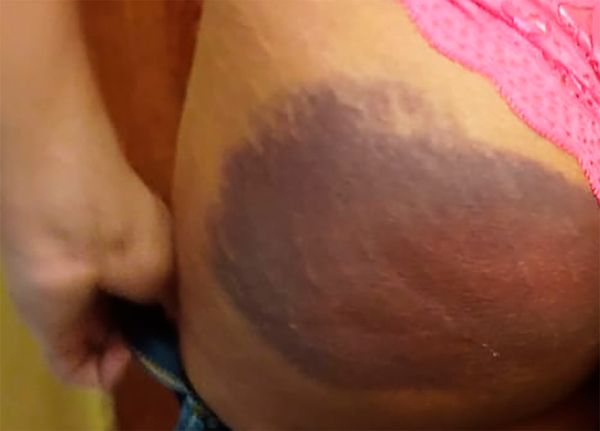 Servidora pública denuncia agressões e tortura em curso no ES