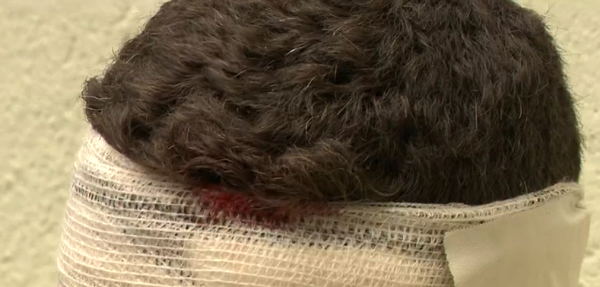 Personal trainer de 28 anos levou quatro coronhadas na cabeça de PM