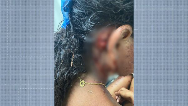 Adolescente grávida de 17 anos foi atacada por cachorros em Guarapari por Reprodução